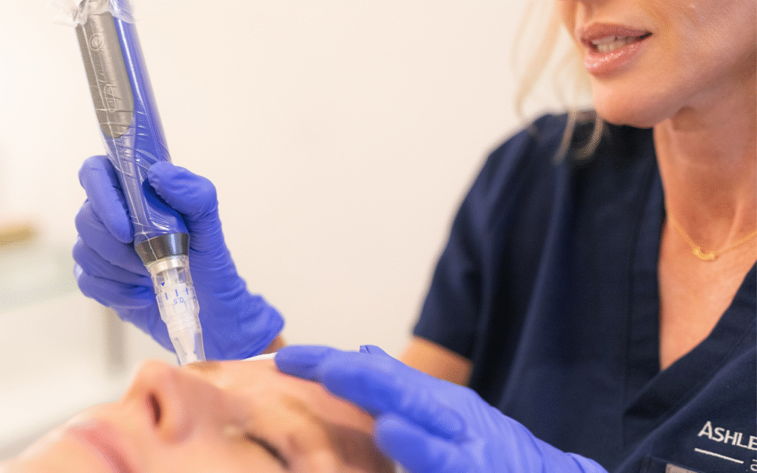 Why Skin Treatments Shouldn’t Stop in the Summer